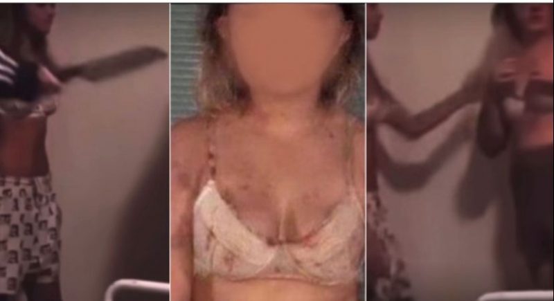 Adolescentes fazem festa falsa para atrair e torturar menina de 13 anos por 5 horas