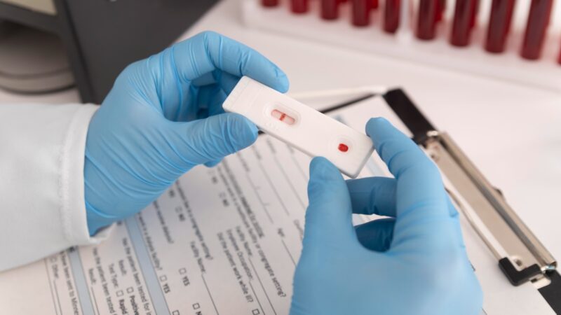 Saúde promove testes rápidos para HIV e outras doenças