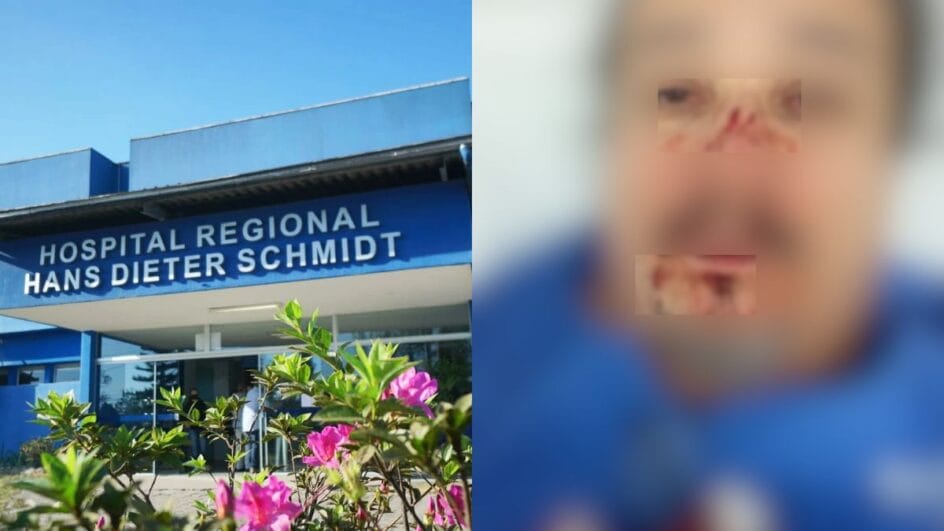 “Puxou cabelo e deu soco”: funcionários são agredidos por acompanhante em hospital de Joinville