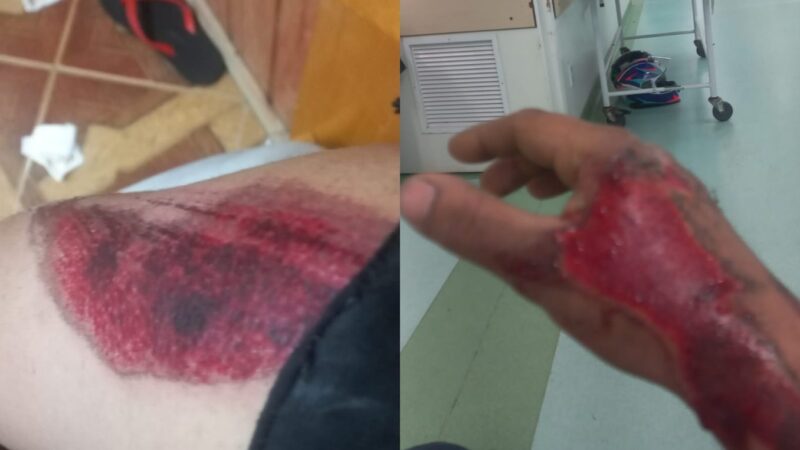 Motorista joga carro contra moto e foge após deixar casal ferido em Florianópolis