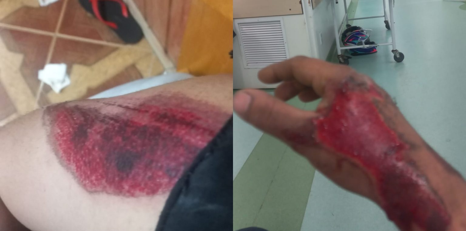 Motorista joga carro contra moto e foge após deixar casal ferido em Florianópolis