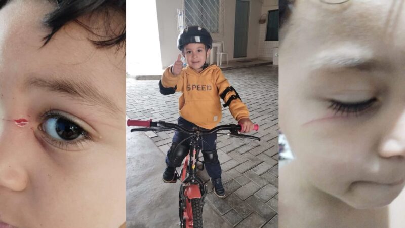 “Poderia ter ficado cego”: menino é ferido por linha de cerol em Balneário Camboriú