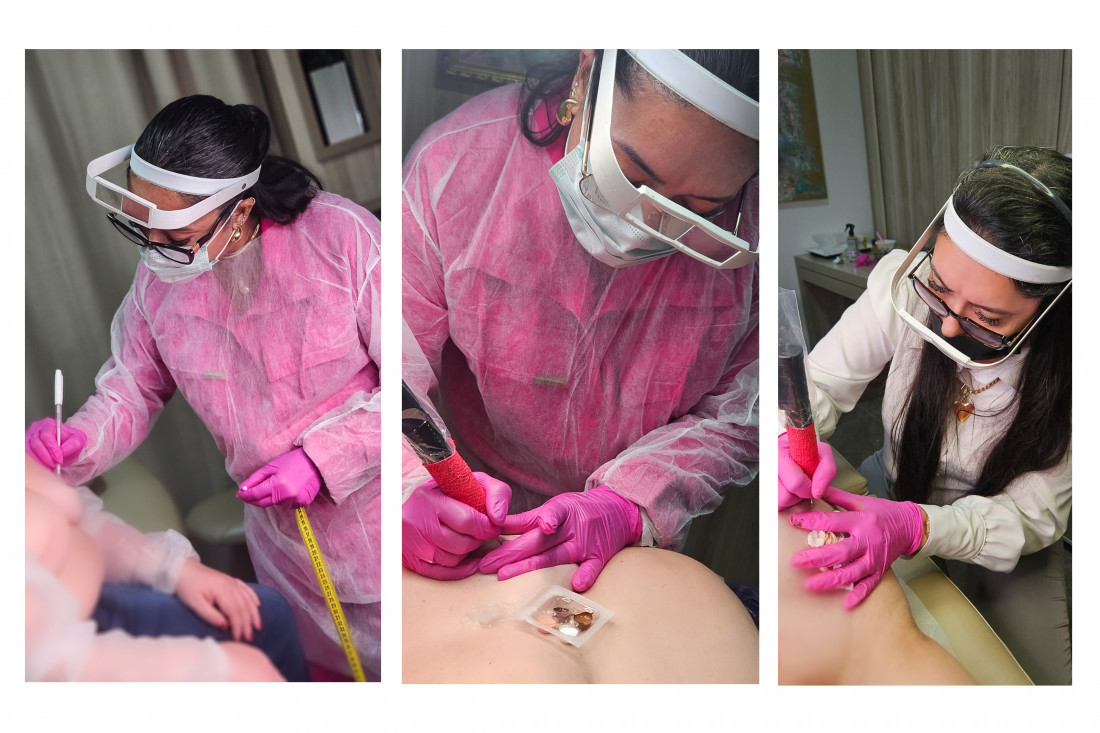 Assembleia Legislativa promove reconstrução de aréolas para mulheres mastectomizadas