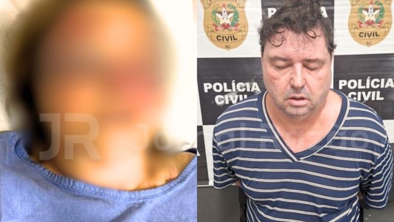 ”Pensei que ia morrer”: idosa relata agressão brutal do próprio filho