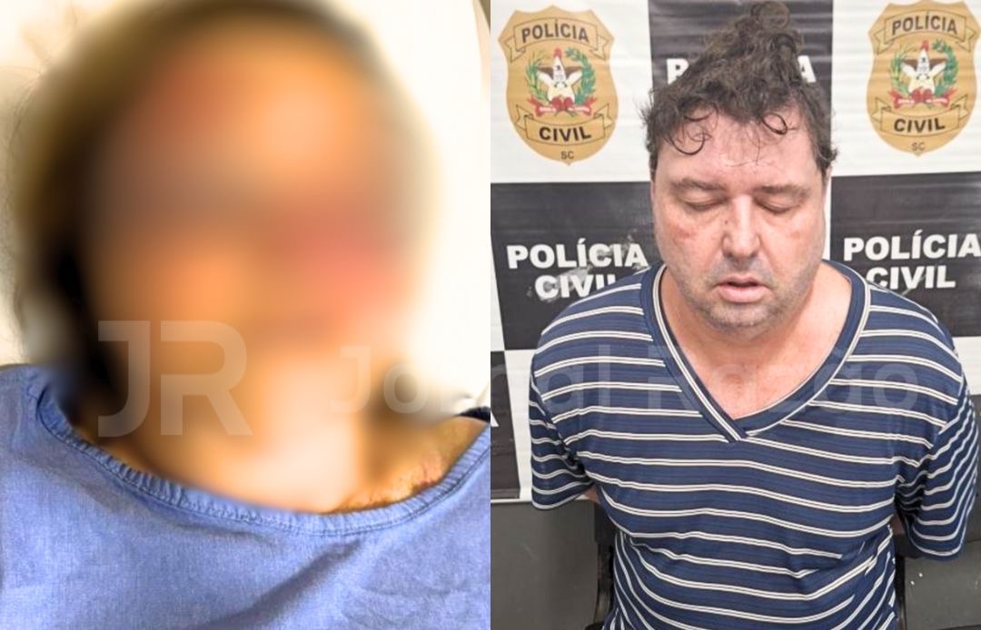 ”Pensei que ia morrer”: idosa relata agressão brutal do próprio filho