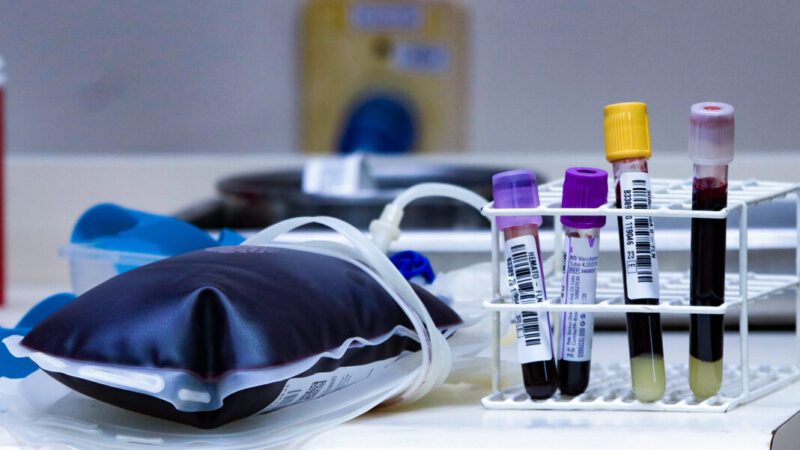 Hemosc de Joaçaba realiza nova coleta externa de sangue em Canoinhas