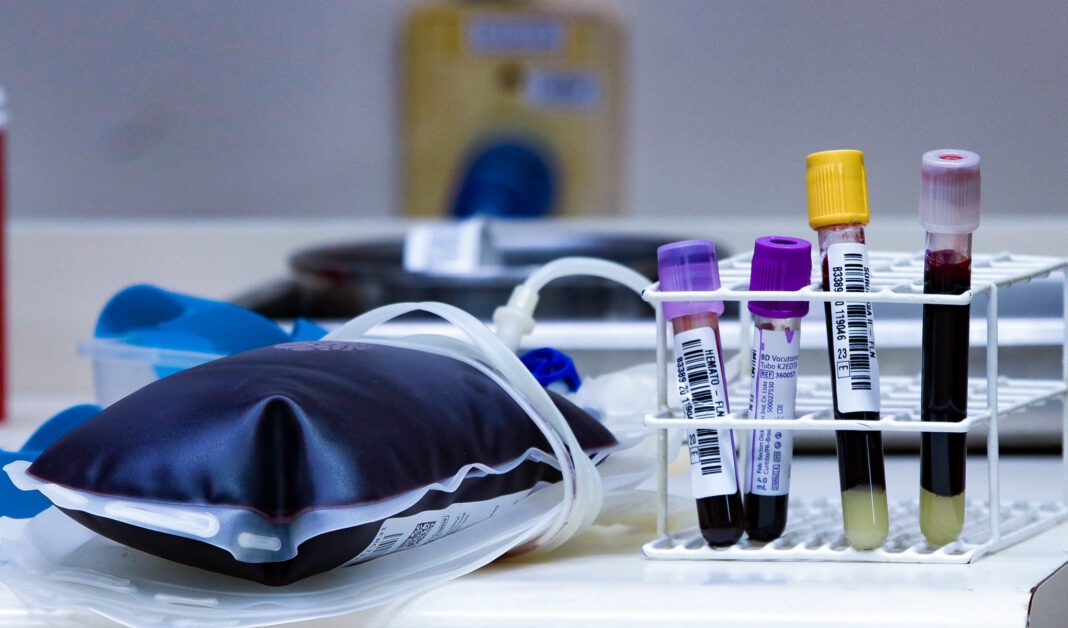 Hemosc de Joaçaba realiza nova coleta externa de sangue em Canoinhas