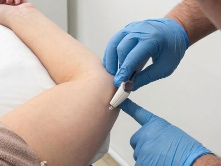 Saúde amplia acesso a métodos contraceptivos com oferta do Implanon pelo SUS
