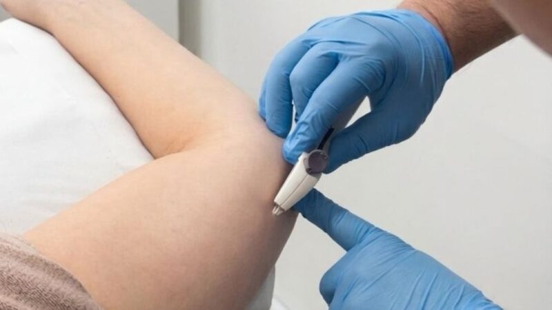 Saúde amplia acesso a métodos contraceptivos com oferta do Implanon pelo SUS