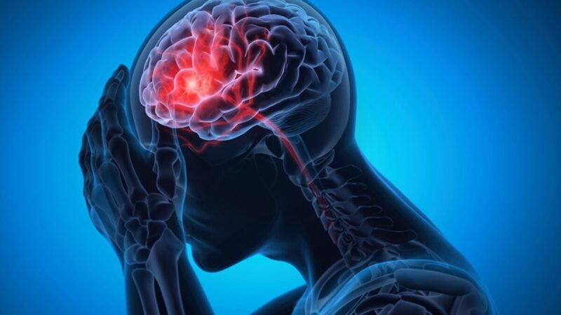 Cirurgia para avc pode funcionar até 72 horas após os sintomas