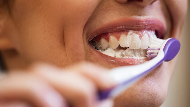 Escovar os dentes com muita força estraga o esmalte e a gengiva