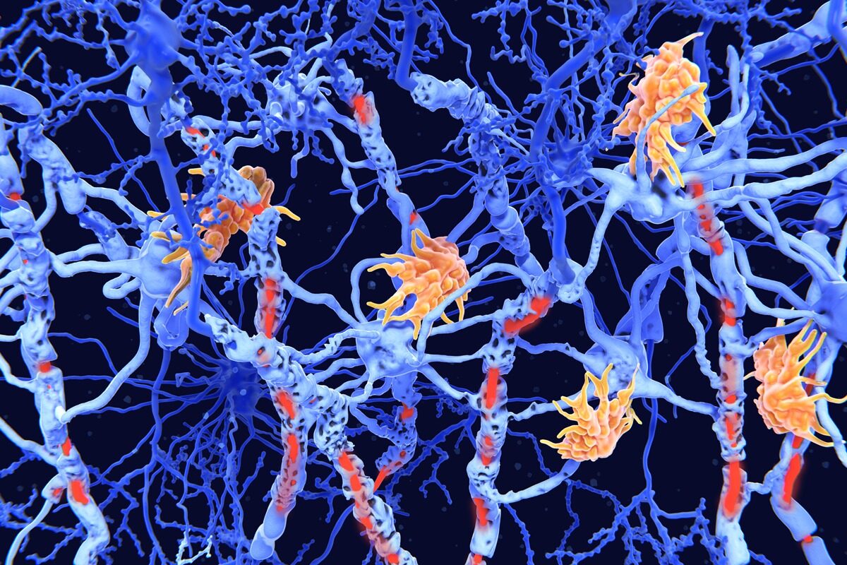 Estudo mostra avanço em terapias inovadoras para doenças neuroimunológicas