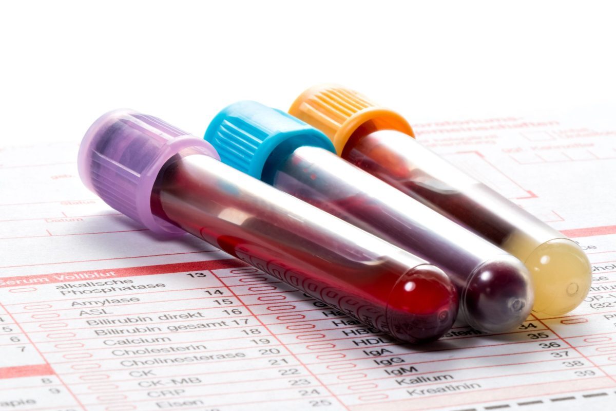 Novo exame de sangue para detectar mais de 50 tipos de câncer chega ao Brasil