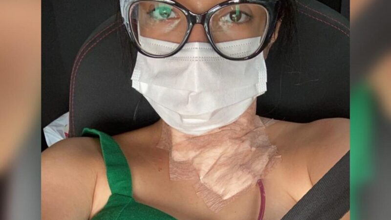 Câncer de tireoide em jovens: sintomas, riscos e diagnóstico